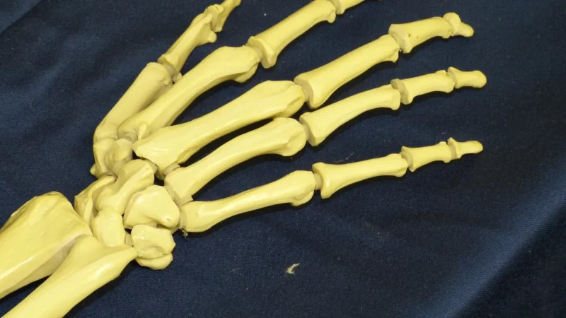 MD SMALL JOINTS na chorobę zwyrodnieniową małych stawów dłoni i stopy 10 amp