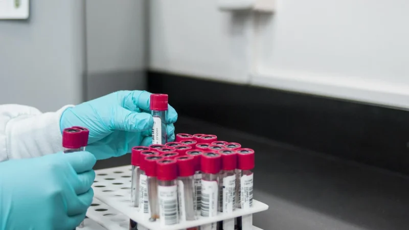 MULTISURE GK Ketone Paski testowe do pomiaru stężenia ciał ketonowych we krwi 10 szt